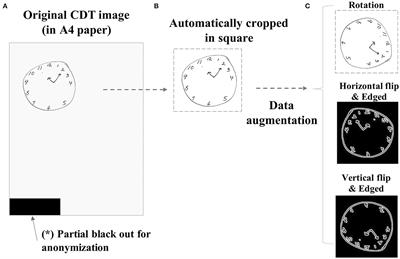 Automated Evaluation of Conventional Clock-Drawing Test Using Deep Neural Network: Potential as a Mass Screening Tool to Detect Individuals With Cognitive Decline